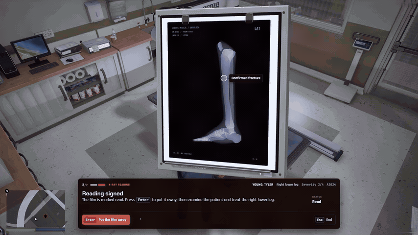 FiveM angiography: finding and coiling an internal bleed