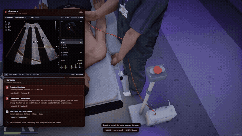 FiveM bedside ultrasound and chest drain